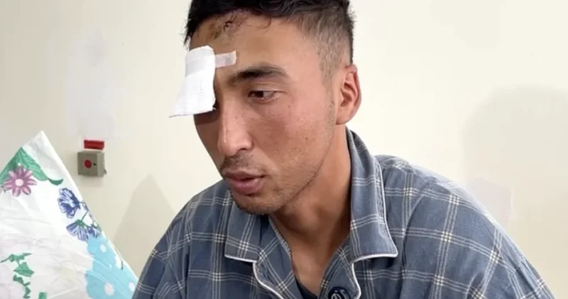 Контрактник лишился глаза во время присяги в Жамбылской области