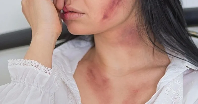 Случайное знакомство в парке закончилось жестоким избиением и тюрьмой в Актобе