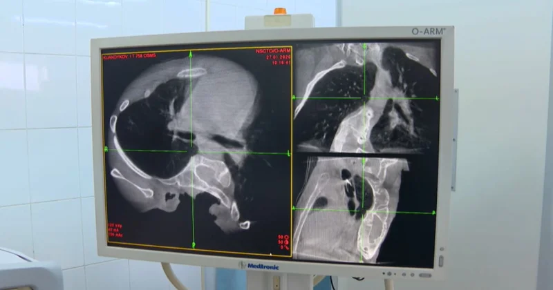 Тегін жасалатын күрделі операциялардың саны артты