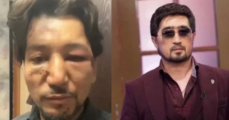 Кешірмеймін : әнші Ғалымжан Сүлеймен өзіне шабуыл жасағандарды жазалауды талап етті