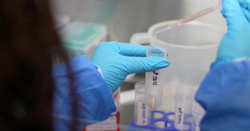 Әлемде 10 млн адам туберкулез жұқтыруы мүмкін