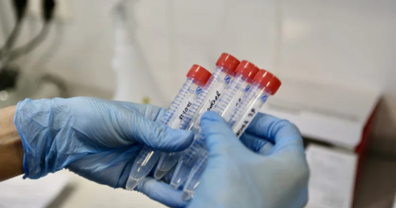 Инфекциялық ауруларға шалдығатындар көбейді. Себебі неде?