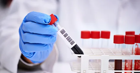 За ошибки в медицинских анализах будут лишать лицензии в Кыргызстане