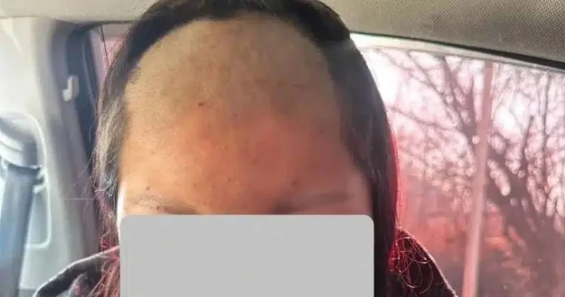 Кәмелетке толмаған қызды ұрып соғып, шашын қырып тастаған (ФОТО)